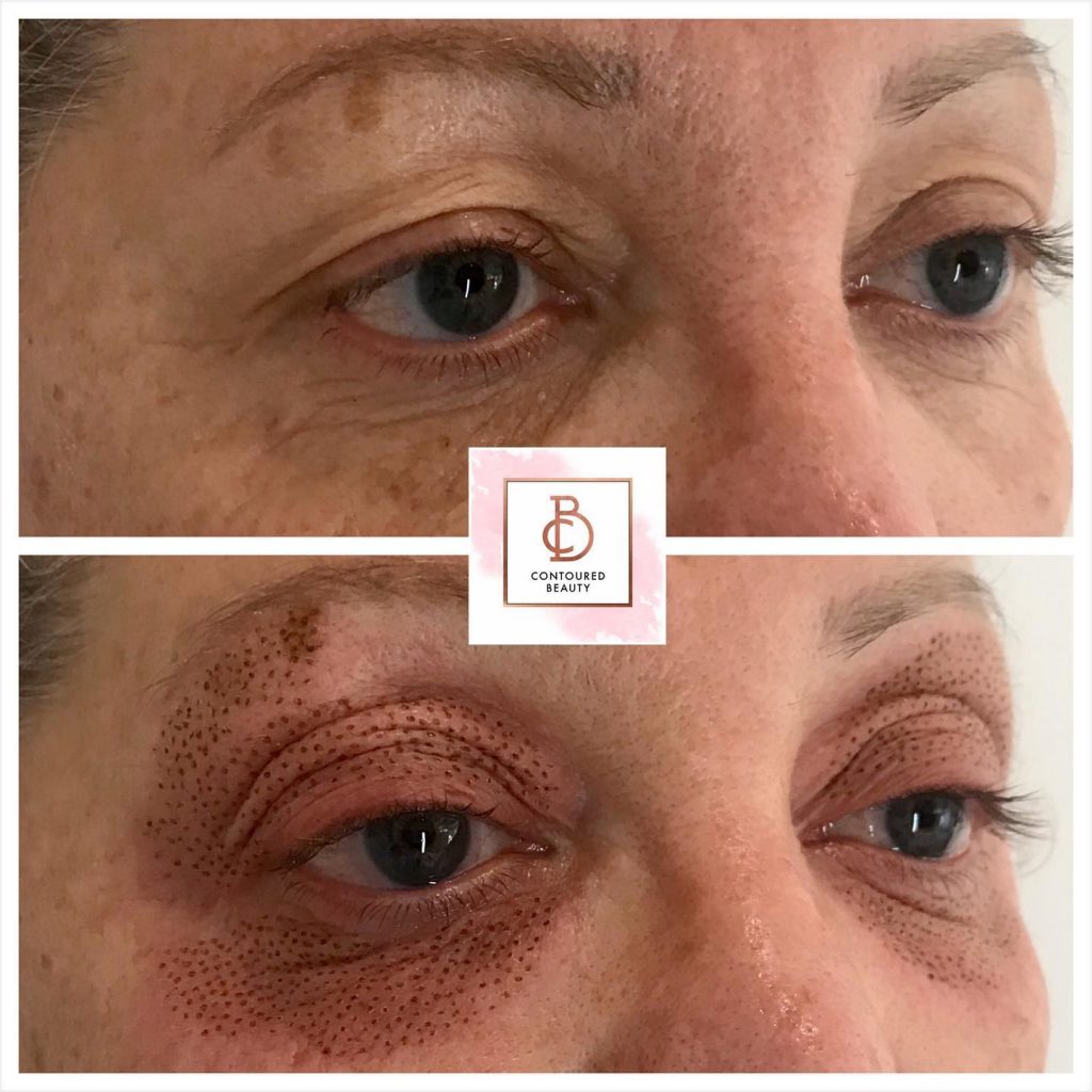 Contour Laser & Aesthetics | Kalon Studio, Pontcanna, Cardiff