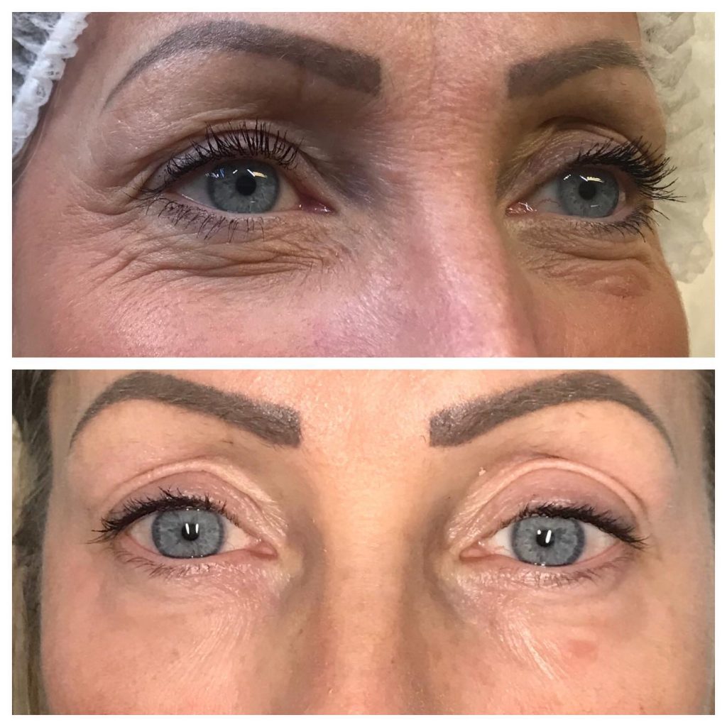 Contour Laser & Aesthetics | Kalon Studio, Pontcanna, Cardiff