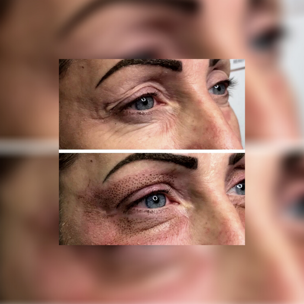 Contour Laser & Aesthetics | Kalon Studio, Pontcanna, Cardiff