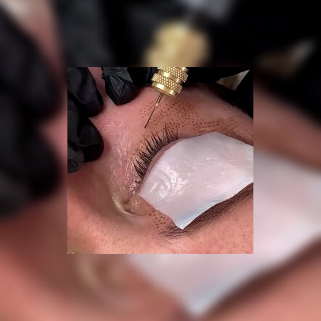 Contour Laser & Aesthetics | Kalon Studio, Pontcanna, Cardiff