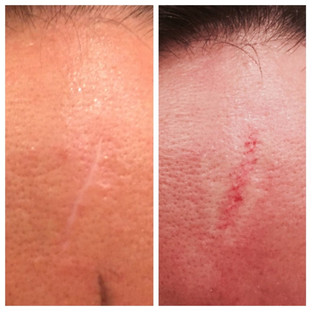 Contour Laser & Aesthetics | Kalon Studio, Pontcanna, Cardiff