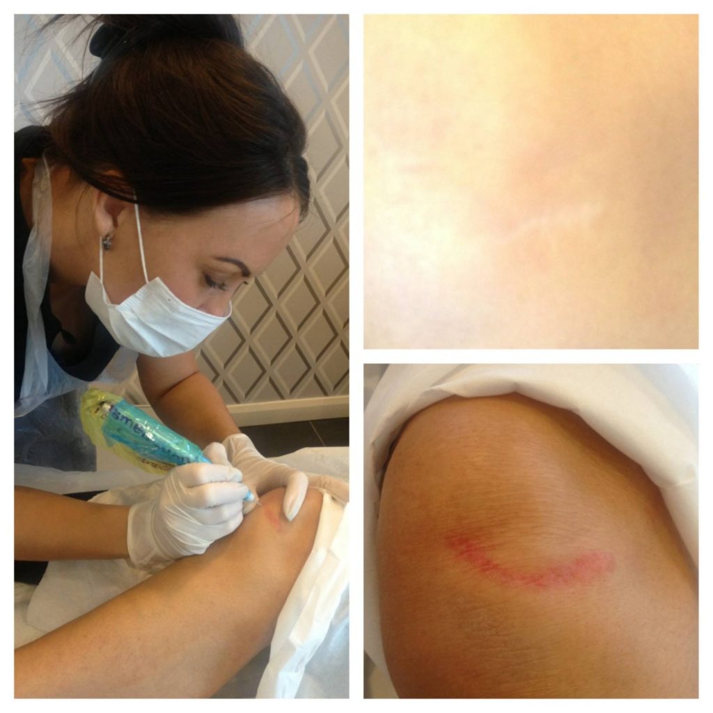 Contour Laser & Aesthetics | Kalon Studio, Pontcanna, Cardiff