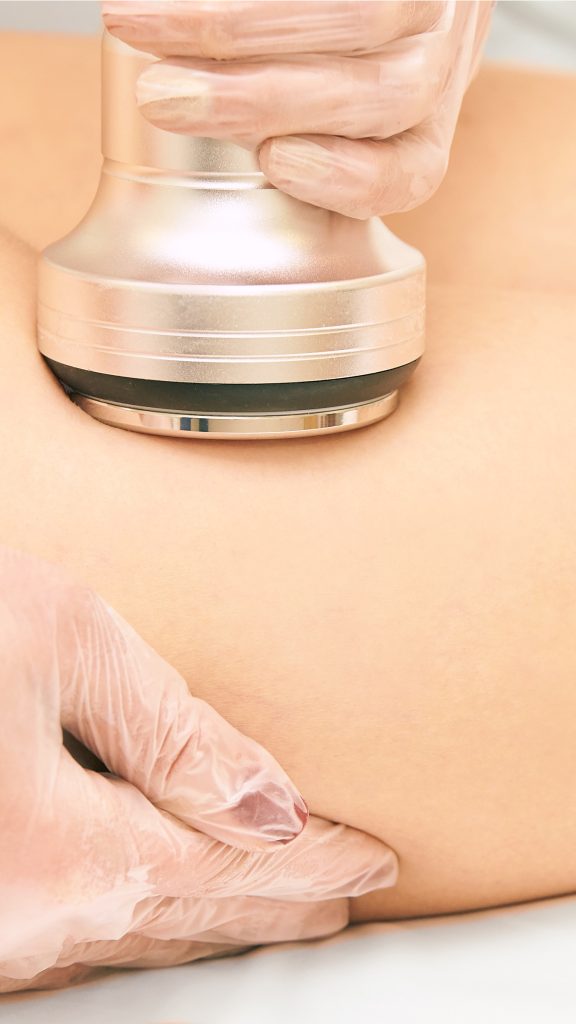 Contour Laser & Aesthetics | Kalon Studio, Pontcanna, Cardiff
