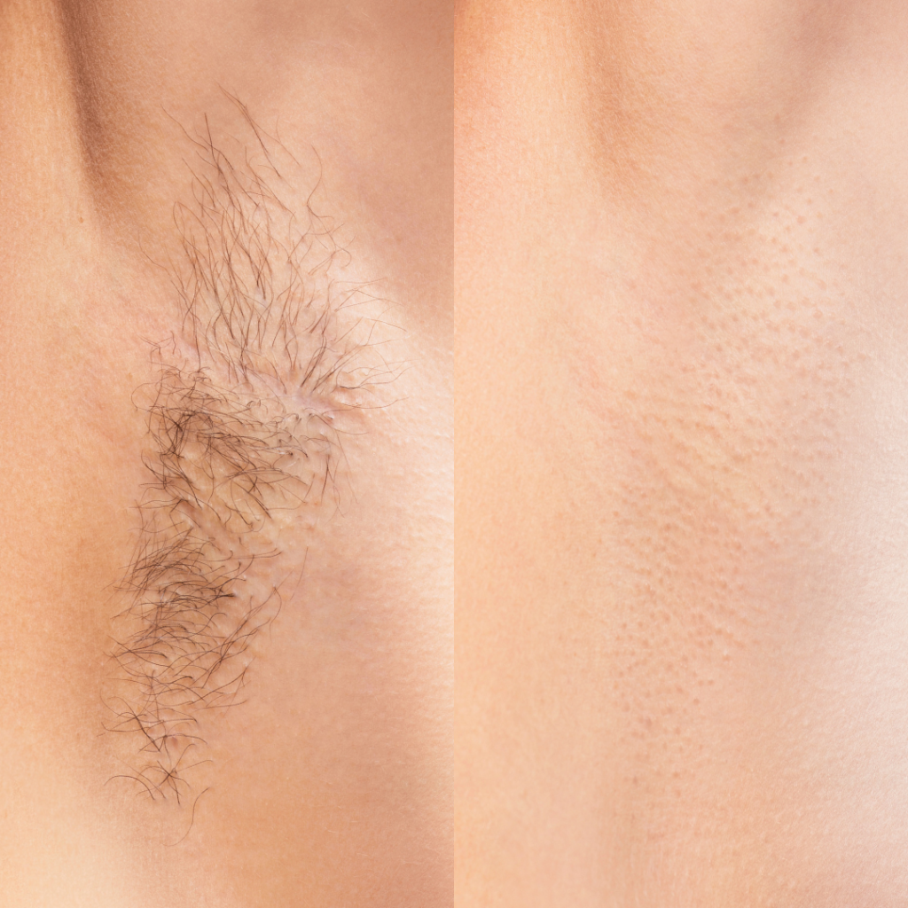 Contour Laser & Aesthetics | Kalon Studio, Pontcanna, Cardiff