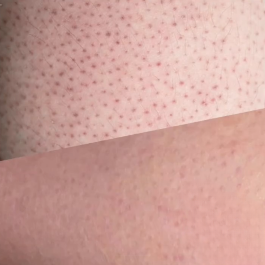 Contour Laser & Aesthetics | Kalon Studio, Pontcanna, Cardiff